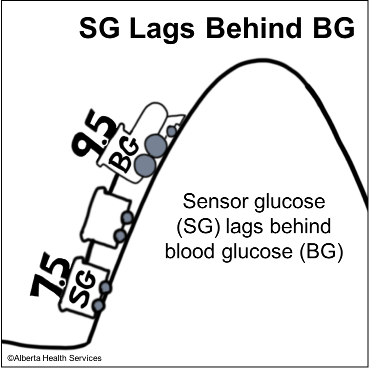 sensor lags behind bg
