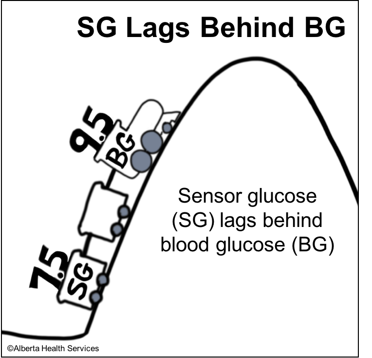 Sensor glucose versus blood glucose