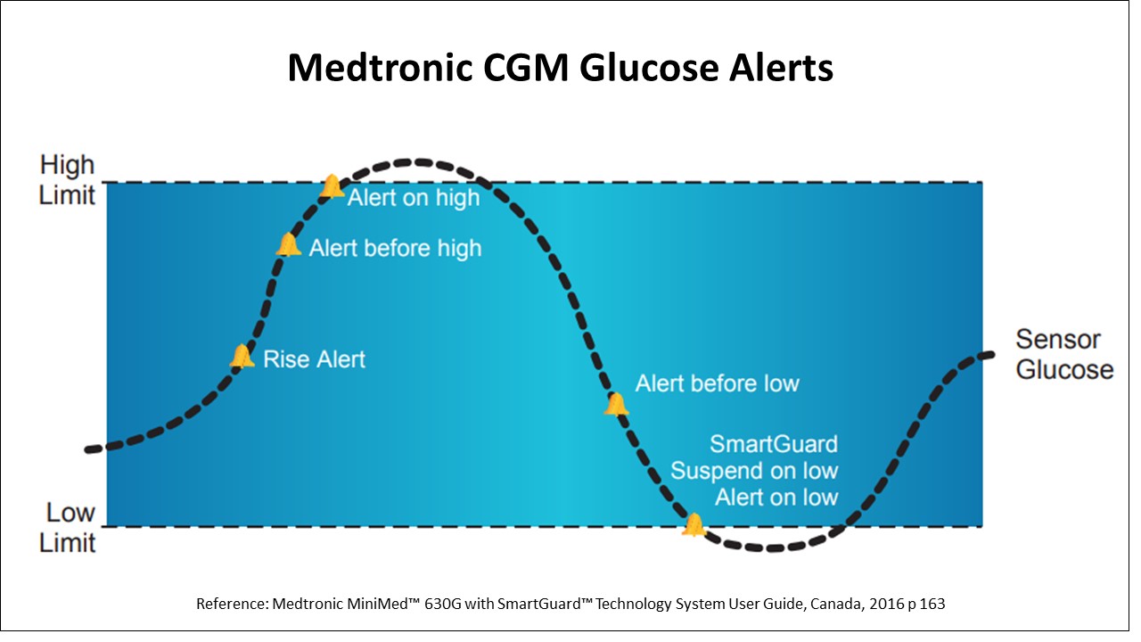 Medtronic Guardian 3 Sensors Diabetes Center Of The Midlands